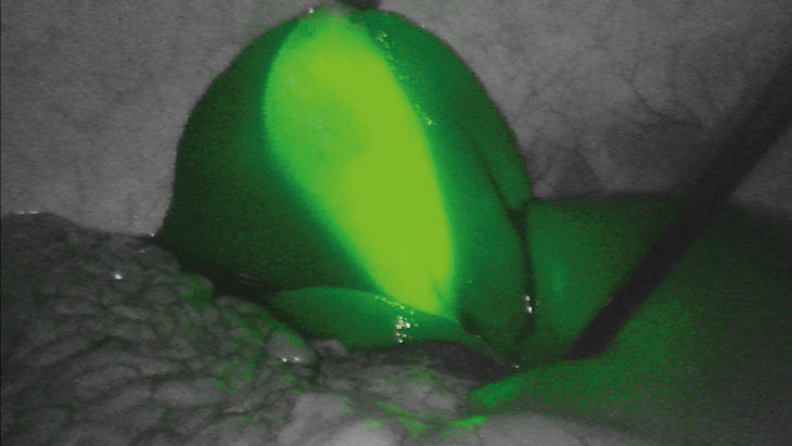 FI zelená – technologie 3D fluorescenčního zobrazování