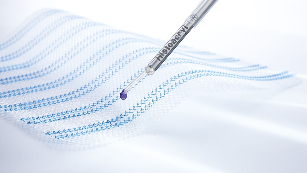 Chirurgická síťka s aplikátorem Histoacryl® LapFix pro fixaci síťky