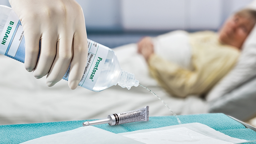 V popředí ruka s lékařskou rukavicí nalévá oplachový roztok Prontosan na podložku položenou na stole vedle tuby s Askina Calgitrol. V pozadí leží pacientka na nemocničním lůžku.