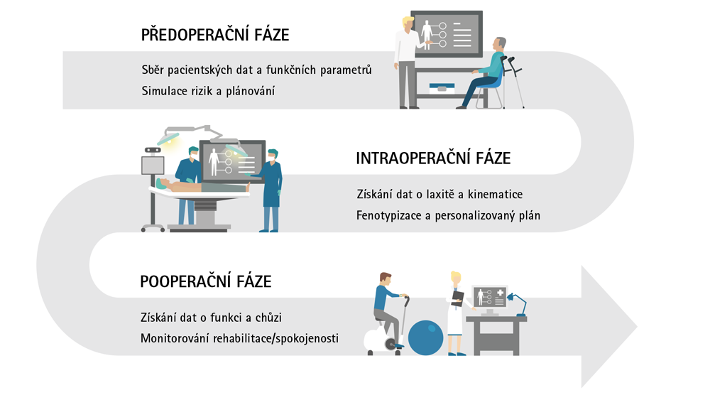 Obrázek procesu, ve kterém předoperační fáze začíná získáváním údajů o pacientovi a jeho funkcích a simulací a plánováním rizik, kde je možné vidět lékaře a pacienta přijímající informace. Proces pokračuje s intraoperační a akviziční laxitou/kinematikou a fenotypizací a personalizovaným plánem, zde je pacient vidět na operačním stole vedle dvou lékařů. Poslední fází je pooperační fáze s akviziční funkcí a chůzí a monitorováním rehabilitace/spokojenosti. Zde vidíte pacienta na stacionárním kole a cvičebním míči vedle lékaře, který ji zaznamenává.
