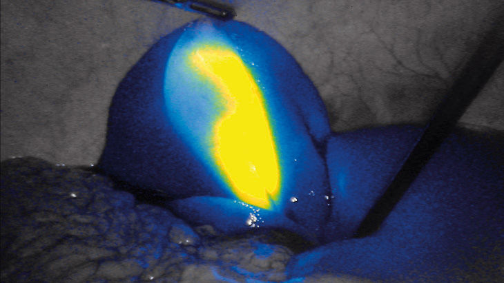 Intenzita FI – technologie 3D fluorescenčního zobrazování
