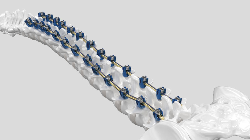 Ennovate® torakolumbální a sakropelvický chirurgický modul