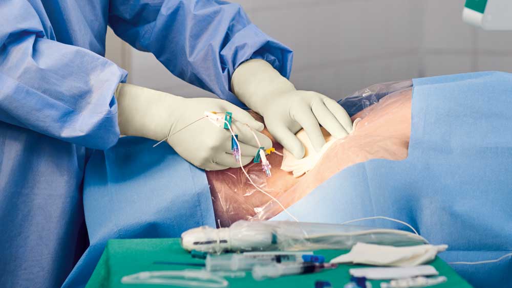 Placement of a centrally inserted central catheter in a sterile field including components and equipment.